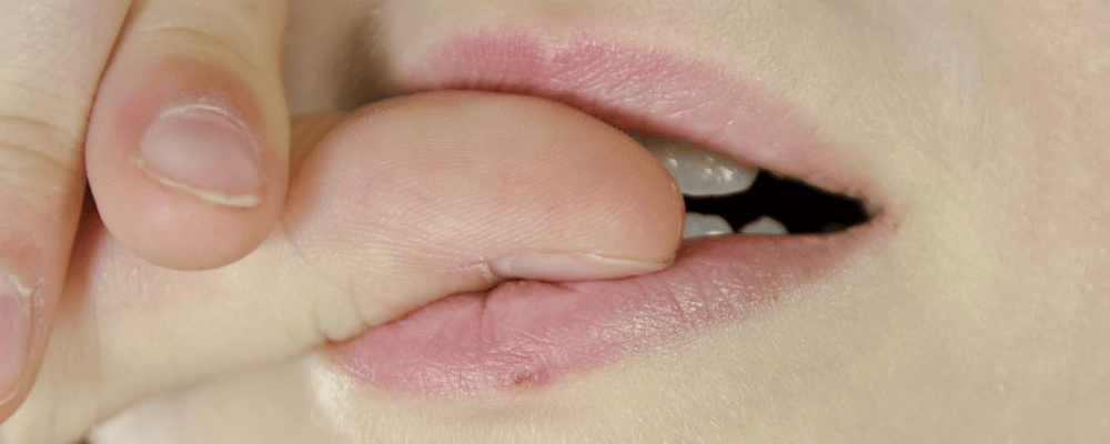 春季嘴唇乾燥、脫皮？教你幾個護唇小妙招，趕緊收藏起來~