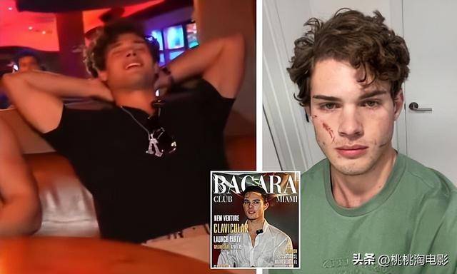 提倡碎骨美容的20歲網紅出事了！直播疑藥物過量，剛出院又赴夜店